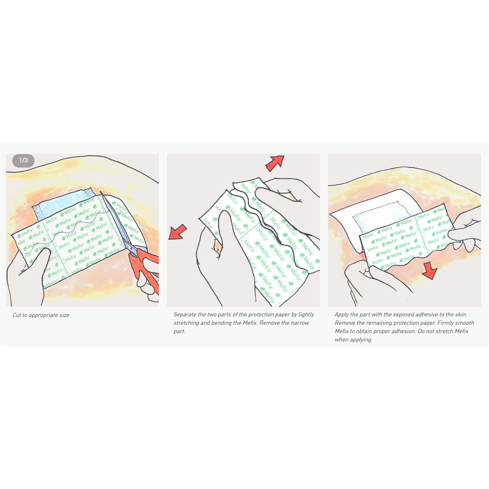 Mefix® Nonwoven Dressing Retention Tape, 2 Inch x 11 Yard 310599