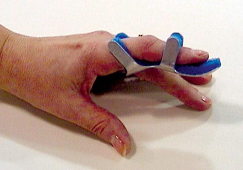 Toad Finger Splint Medium Bulk PK/6: Comfortable Support for Finger Injuries