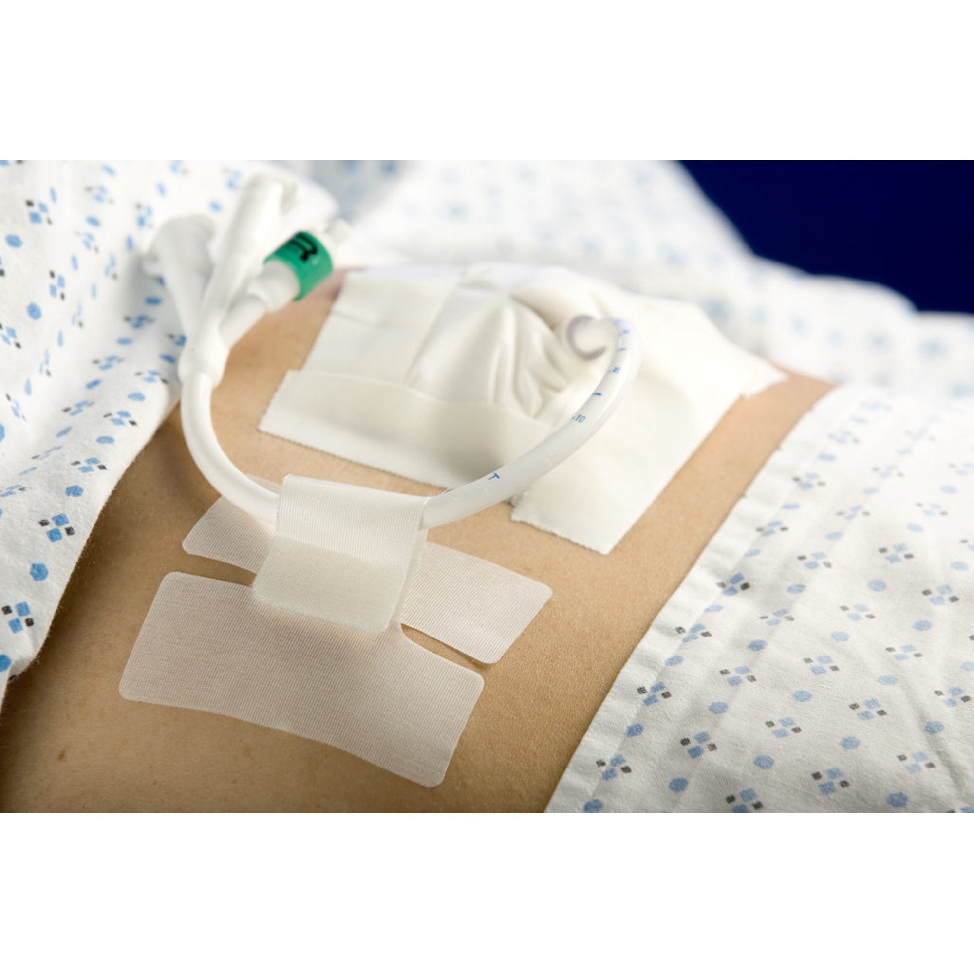 Cath-Secure™ Holder, Tube 5445-2