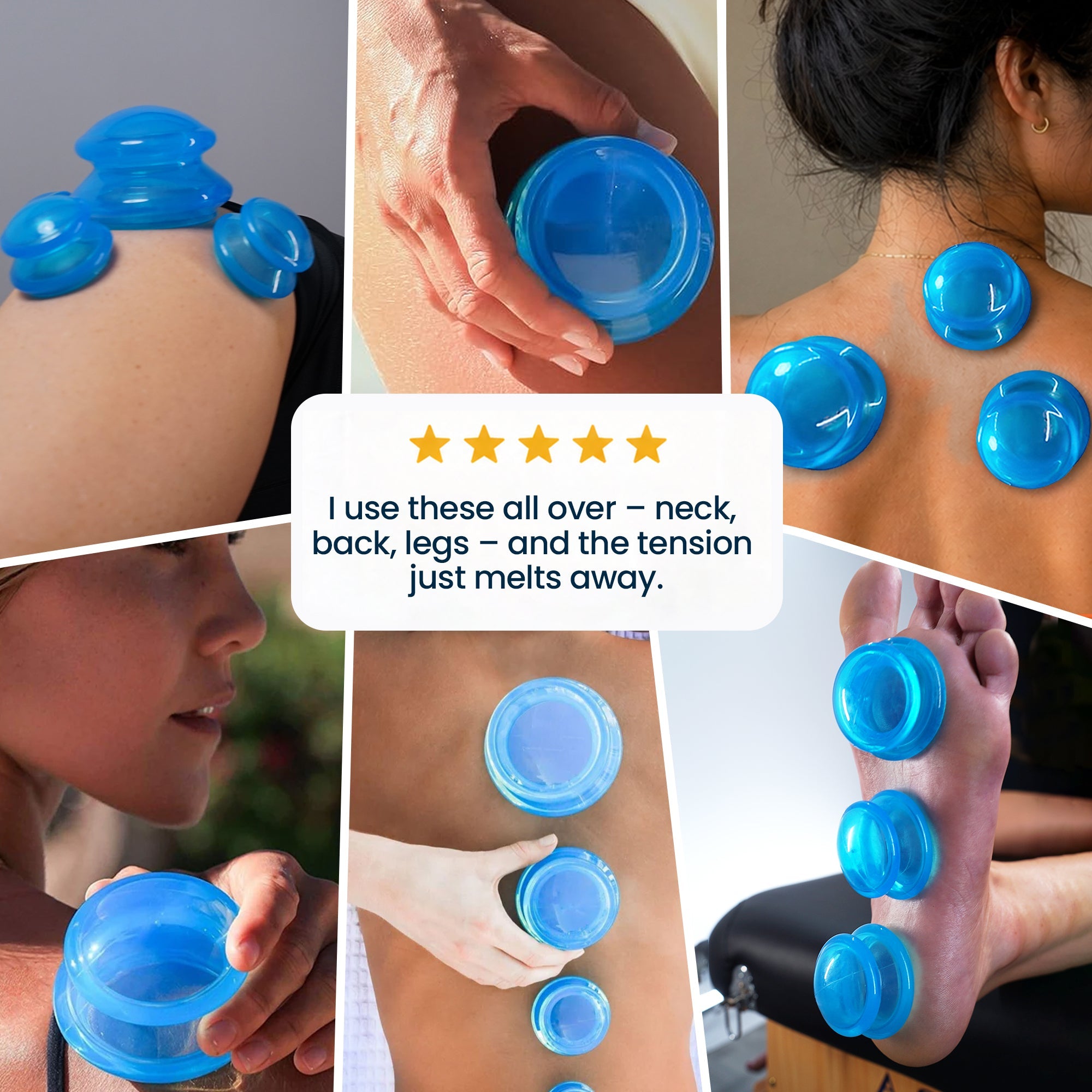 EDGE™ Cupping Set Blue, 8 Cups (2L, 2M, 4S)