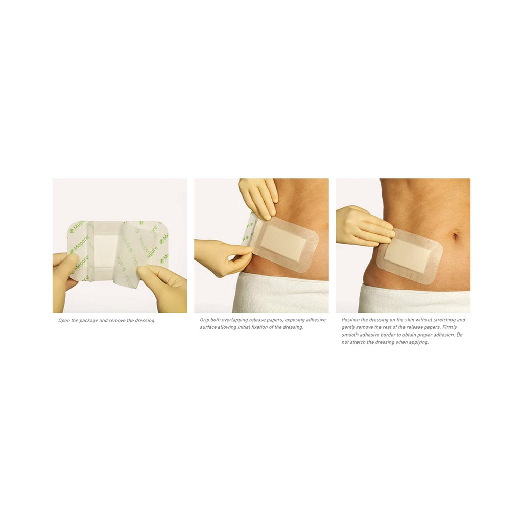 Mepore® Pro White Adhesive Dressing, 3 x 4 inch 670990