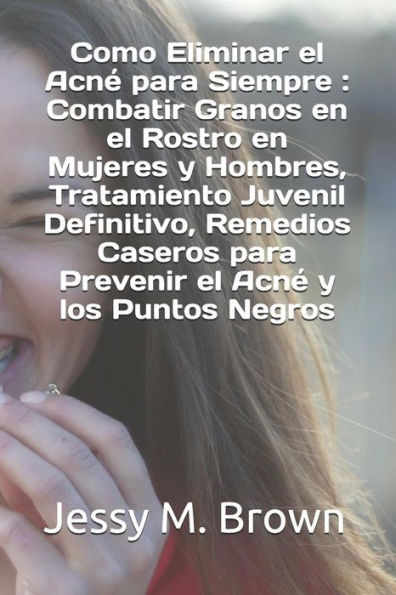 Como Eliminar el Acn� para Siempre : Combatir Granos en el Rostro en Mujeres y Hombres, Tratamiento Juvenil Definitivo, Remedios Caseros para Prevenir el Acn� y los Puntos Negros (Spanish Edition)