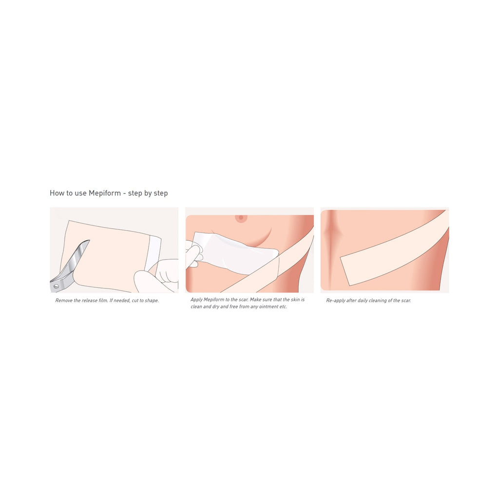 Mepiform® Self Adherent Silicone Dressing, 4 x 7 Inch 293499