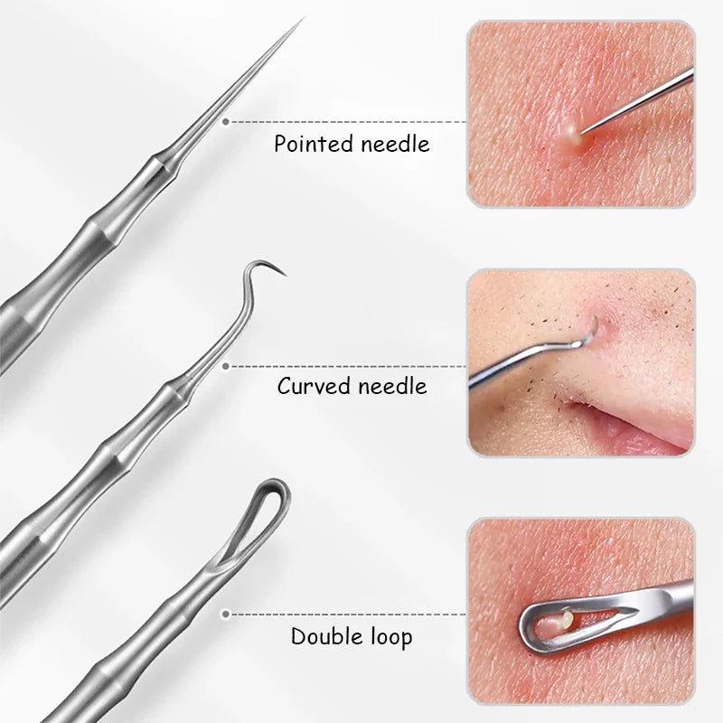 Acne and Pimples Removal Needles.