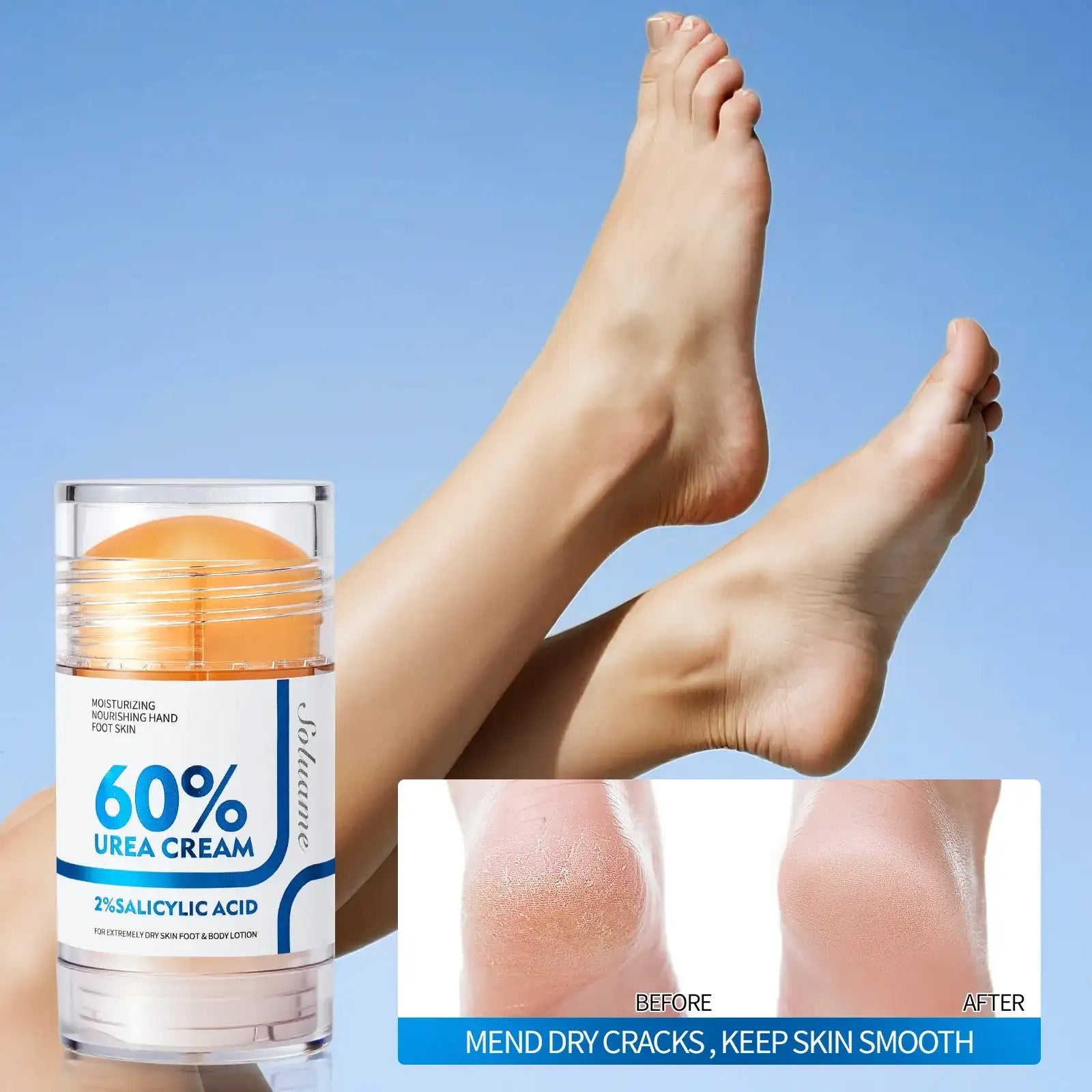 Foot Cream 60% Urea