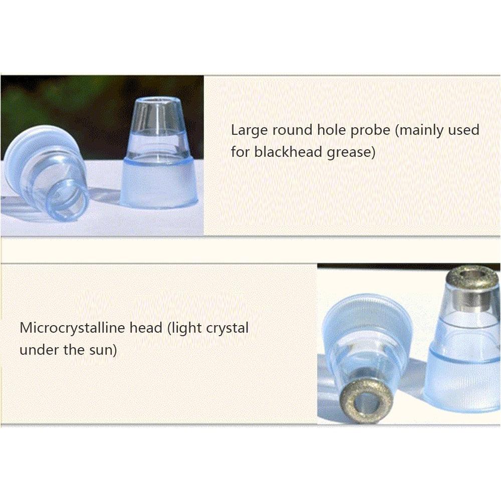 Multifunctional Beauty Pore Vacuum