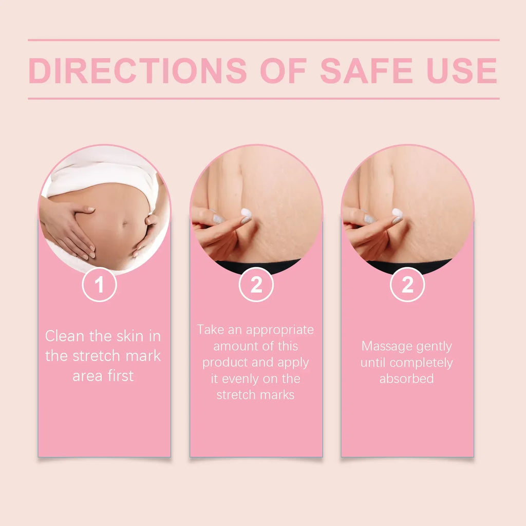Pregnancy Stretch Marks Removal Cream Anti Fine Lines Repair Crack Firming Skin Eliminate Red White Old Pregnancy Marks Cream