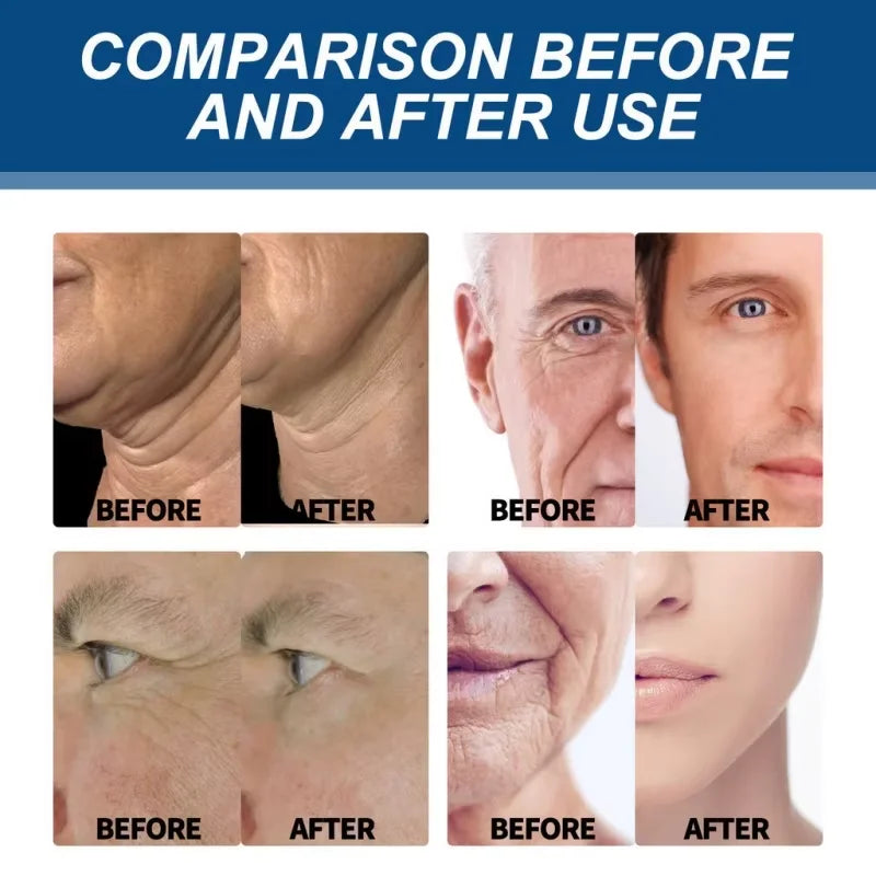 Retinol Anti-wrinkle Cream For Men Collagen Anti-Aging Removal Face Neck Wrinkle Efficient Moisturizing Firming Korean Skin Care