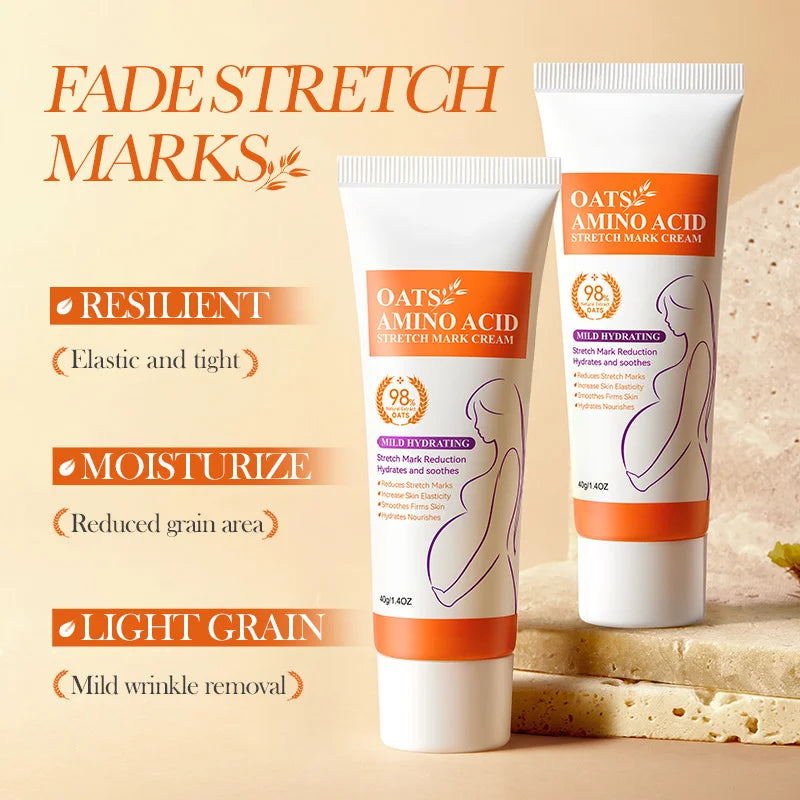 Cream For Pregnancy Stretch Marks Removal Eliminate Red White Old Stretch Marks 26