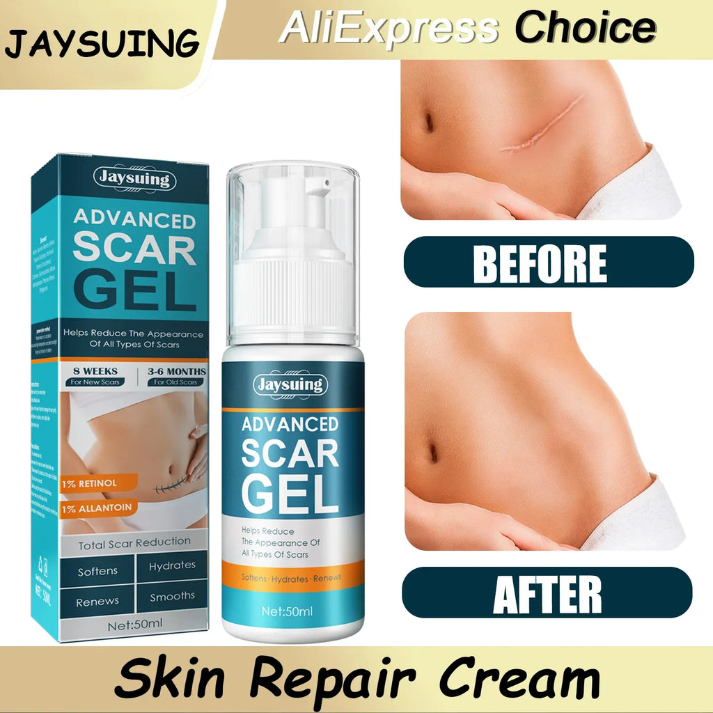 Skin Care Cream Scars Repair Gel Face Body Lotion Smoothing Hydrating Stretch Marks Cream Post Surgery Scar Care Gel Moisturize