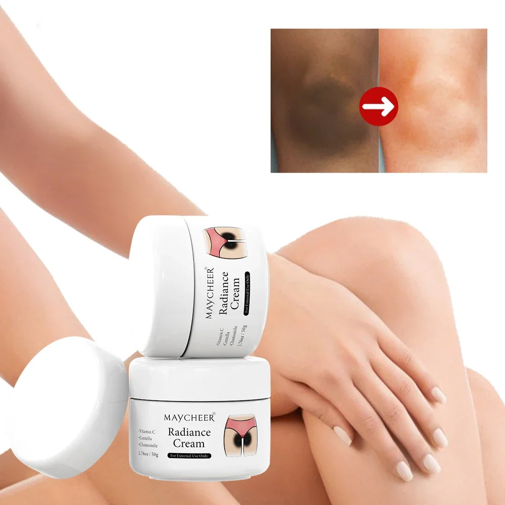 50g Whitening Cream Private Parts Underarm Bleaching Whiten Butt Knee Brighten Inner Thigh Intimate Parts Dark Remove Melanin