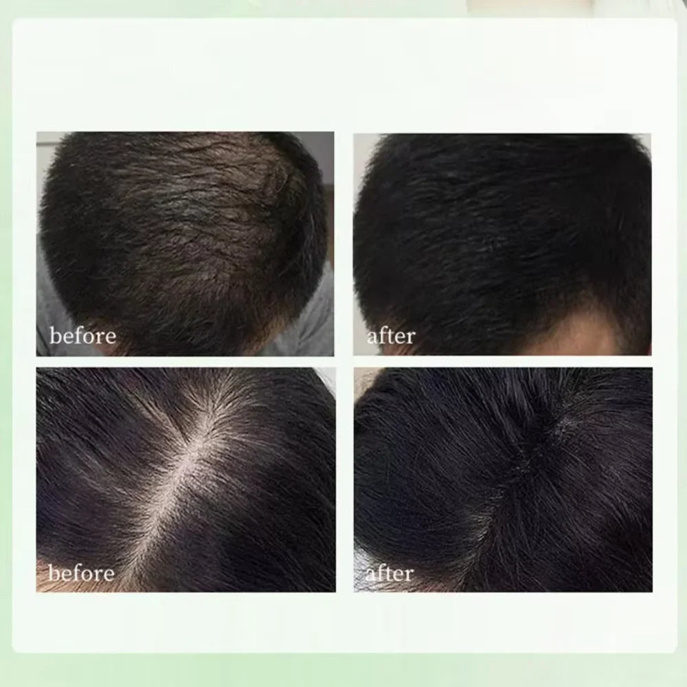 Natural Herbal Shampoo Soap Usman Grass Handmade Soap Hair Nourishing, Oil Control, Refreshing, Fluffy and Soothing Hair Care