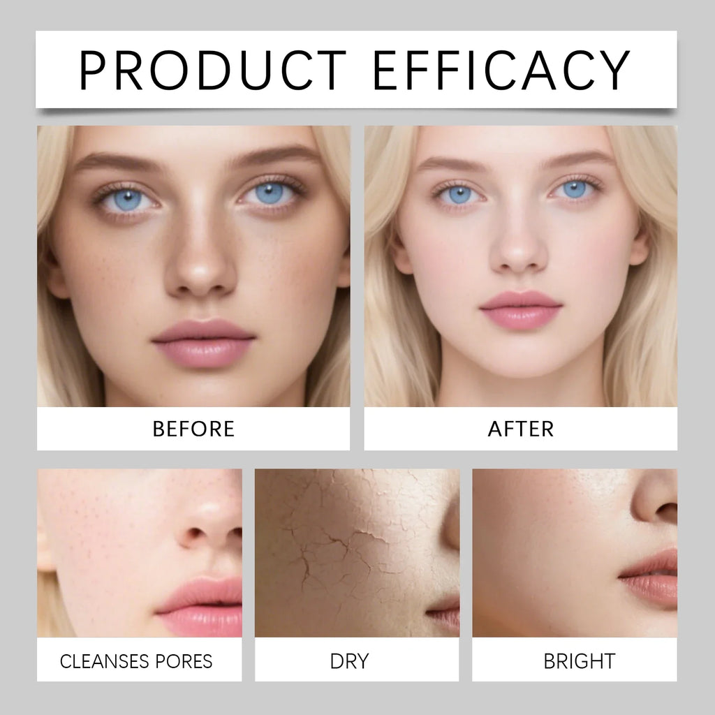 HOYGI Facial Cleansing Gel Oil Control Moisturizing Face Wash Anti-Acne Pore Refining Blackhead Remover Gentle Brightening Skin