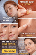 Acne patches - PhishStones Products