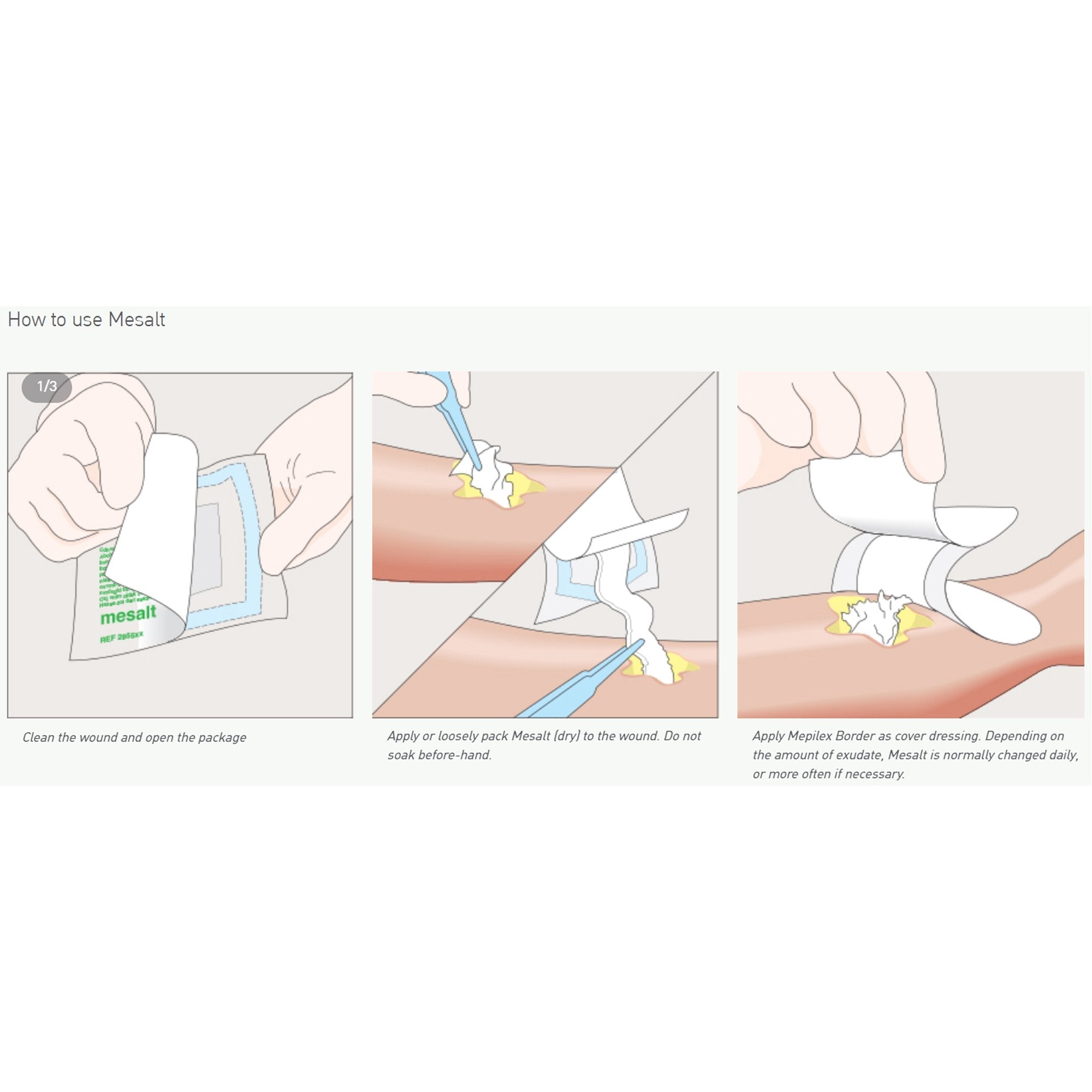 Mesalt® Sodium Chloride Impregnated Dressing, ¾ x 39 Inch 285280