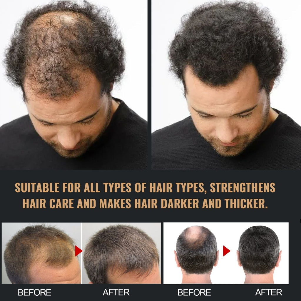 Root Activator Shampoo, Natural Hair Regrowth Shampoos, Unisex Hair Thickening Shampoo, Gently Shampoo For Men & Women, Nourishing Long Lasting Hair Care For Darker & Thicker Hair