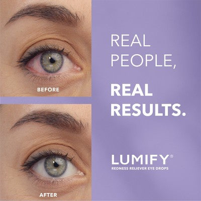Lumify Eye Drops for Redness Relief 2.5ml - Missing Box - PhishStones Products